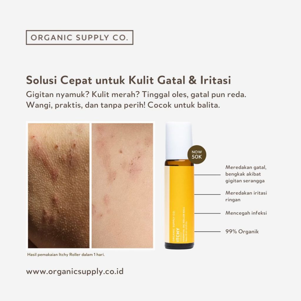 Itchy Essential Oil Roller Ball