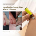 Ouchie Essential Oil Roller Ball