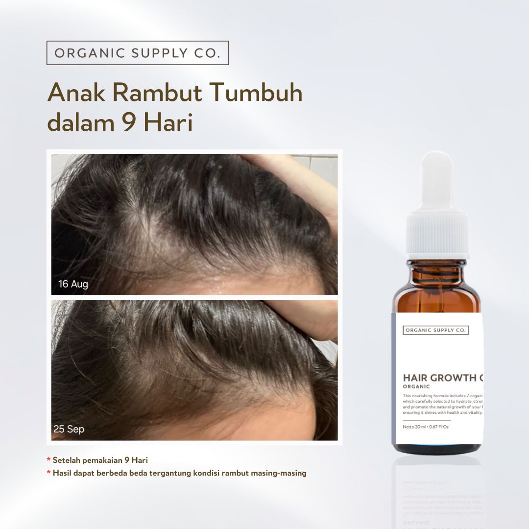 Hair Growth Oil