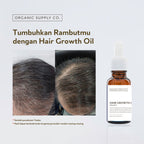 Hair Growth Oil