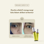 Ouchie Essential Oil Roller Ball