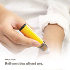 Itchy Essential Oil Roller Ball