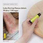 Ouchie Essential Oil Roller Ball